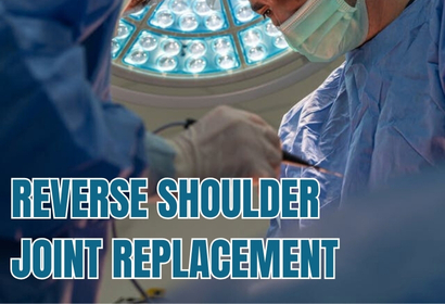 Reverse Shoulder by Dr Karthik Gudaru